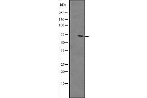 Western blot analysis of GBP2 expression in human liver tissue lysate ;,The lane on the left is treated with the antigen-specific peptide. (GBP2 antibody  (Internal Region))