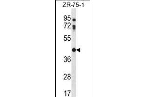 CTSO Antibody (N-term) (ABIN656692 and ABIN2845928) western blot analysis in ZR-75-1 cell line lysates (35 μg/lane). (CTSO antibody  (N-Term))