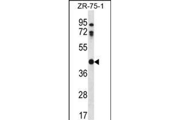 CTSO 抗体  (N-Term)