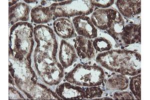 Image no. 1 for anti-NADH Dehydrogenase (Ubiquinone) 1 beta Subcomplex, 10, 22kDa (NDUFB10) antibody (ABIN1499668) (NDUFB10 antibody)