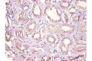 Immunohistochemistry of paraffin-embedded human kidney tissue using ABIN7149627 at dilution of 1:100 (DHRS9 antibody  (AA 23-319))