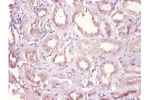 Immunohistochemistry of paraffin-embedded human kidney tissue using ABIN7149627 at dilution of 1:100 (DHRS9 antibody  (AA 23-319))