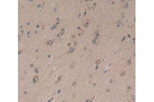 Used in DAB staining on fromalin fixed paraffin- embedded Kidney tissue (Neurocan antibody  (AA 1008-1273))
