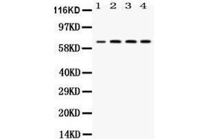Western blot analysis of YY1 expression in rat lung extract (lane 1), JURKAT whole cell lysates (lane 2), CEM whole cell lysates (lane 3) and HEPG2 whole cell lysates (lane 4).