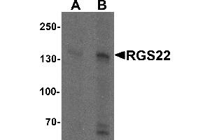 Western blot analysis of RGS22 in Jurkat cell lysate with RGS22 antibody at (A) 1 and (B) 2 µg/mL. (RGS22 antibody  (N-Term))