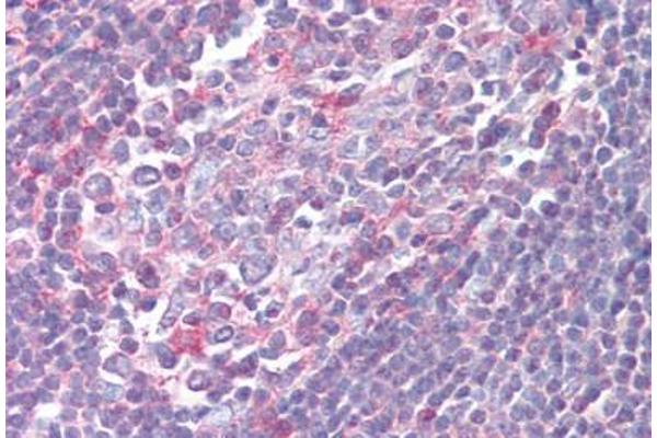 XCR1 antibody  (Cytoplasmic Domain)