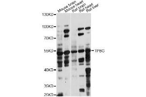 Western blot analysis of extracts of various cell lines, using TPBG antibody (ABIN6291221) at 1:1000 dilution.