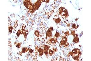 IHC testing of FFPE human pituitary gland with ACTH antibody (clone ADCT1-1). (CLIP antibody  (AA 25-39))