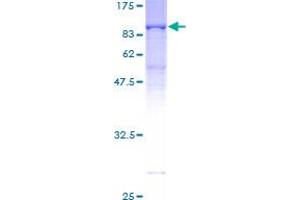RANGAP1 Protein (AA 1-587) (GST tag)