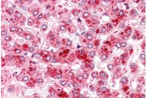 Human Liver: Formalin-Fixed, Paraffin-Embedded (FFPE) (COMT antibody  (N-Term))