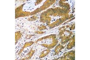 Immunohistochemistry (IHC) image for anti-Tumor Protein P53 (TP53) (N-Term) antibody (ABIN7303988)