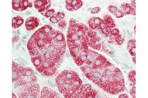 Formalin-fixed and paraffin-embedded H. (STRN4 antibody  (N-Term))