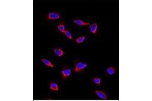 Immunofluorescence analysis of anti-SOX9 Antibody (N-term) in HeLa cells.