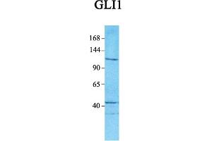 Host:  Rabbit  Target Name:  GLI1  Sample Tissue:  Human Jurkat  Antibody Dilution:  1. (GLI1 antibody  (C-Term))