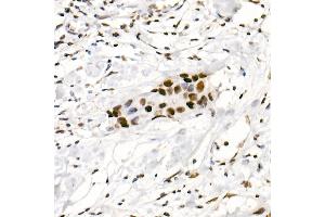 Immunohistochemistry of paraffin-embedded human placenta using DDX3X Rabbit pAb (ABIN6130252, ABIN6139494, ABIN6139495 and ABIN6221274) at dilution of 1:100 (40x lens).