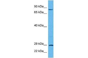 Host:  Rabbit  Target Name:  TRIM32  Sample Tissue:  Human HCT116 Whole Cell  Antibody Dilution:  1ug/ml