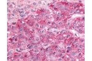 Immunohistochemistry (IHC) image for anti-G Protein-Coupled Receptor, Family C, Group 5, Member C (GPRC5C) (C-Term) antibody (ABIN2469418)