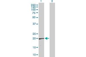 Western Blot analysis of RLN1 expression in transfected 293T cell line by RLN1 MaxPab polyclonal antibody. (Relaxin 1 antibody  (AA 1-185))