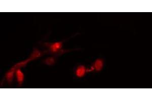 ABIN6267679 staining HeLa cells by IF/ICC. (HDAC2 antibody  (pSer394))
