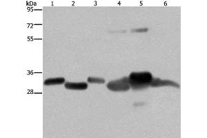 Western Blot analysis of Mouse thymus and Human ovarian cancer tissue, Mouse heart, Human fetal liver, Mouse liver tissue and SKOV3 cell using HMGCL Polyclonal Antibody at dilution of 1:300