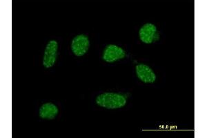 Immunofluorescence of  purified  MaxPab antibody to C19orf50 on HeLa cell. (C19orf50 antibody  (AA 1-176))