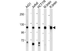 All lanes : Anti-PI3KCA Antibody (Center) at 1:2000 dilution Lane 1: A431 whole cell lysate Lane 2: Jurkat whole cell lysate Lane 3: HC whole cell lysate Lane 4: Mouse brain tissue lysate Lane 5: Rat brain tissue lysate Lysates/proteins at 20 μg per lane.