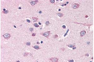 Human Brain, Cortex (formalin-fixed, paraffin-embedded) stained with MFI2 antibody ABIN351428 at 15 ug/ml followed by biotinylated goat anti-rabbit IgG secondary antibody ABIN481713, alkaline phosphatase-streptavidin and chromogen. (MFI2 antibody  (N-Term))