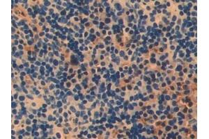 Immunohistochemistry (IHC) image for anti-Poly (ADP-Ribose) Polymerase 1 (PARP1) (AA 661-881) antibody (ABIN7439663)