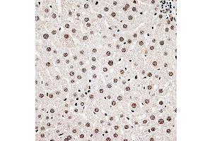 Immunohistochemistry of paraffin-embedded rat liver using CBX6 antibody (ABIN6127558, ABIN6138026, ABIN6138027 and ABIN6221185) at dilution of 1:100 (40x lens). (CBX6 antibody  (AA 80-180))