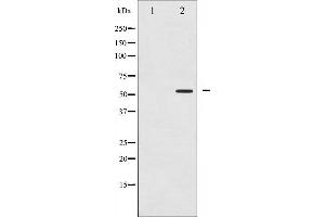 Western blot analysis of PPAR- gamma phosphorylation expression in Paclitaxel treated Jurkat whole cell lysates,The lane on the left is treated with the antigen-specific peptide. (PPARG antibody  (pSer112))