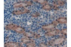 Detection of HGD in Mouse Kidney Tissue using Polyclonal Antibody to Homogentisate-1,2-Dioxygenase (HGD) (HGD antibody  (AA 190-429))