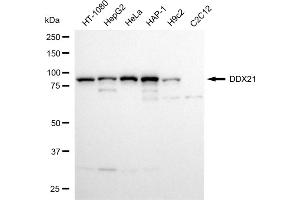 anti-DEAD (Asp-Glu-Ala-Asp) Box Polypeptide 21 (DDX21) antibody