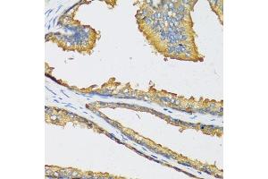 Immunohistochemistry of paraffin-embedded human prostate using CXCL11 antibody (ABIN6130151, ABIN6139269, ABIN6139270 and ABIN6221788) at dilution of 1:100 (40x lens). (CXCL11 antibody  (AA 22-94))