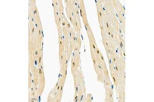 Immunohistochemistry of paraffin embedded mouse heart using COPS2 (ABIN7073324) at dilution of 1:1400 (400x lens) (CSN2 antibody)