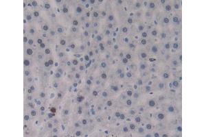 Used in DAB staining on fromalin fixed paraffin- embedded Kidney tissue (PTPRJ antibody  (AA 1033-1277))