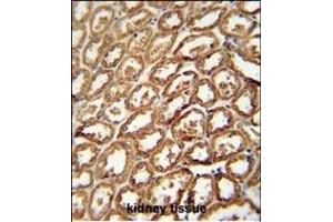 DEGS2 antibody (C-term) (ABIN654539 and ABIN2844256) immunohistochemistry analysis in formalin fixed and paraffin embedded human kidney tissue followed by peroxidase conjugation of the secondary antibody and DAB staining.