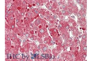 IHC-P analysis of Human Liver Tissue, with HE staining. (CPT1A antibody  (AA 191-353))