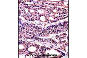 Immunohistochemistry (Paraffin-embedded Sections) (IHC (p)) image for anti-High Mobility Group Box 1 (HMGB1) (AA 152-180), (C-Term) antibody (ABIN1536601)