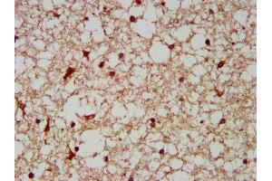 IHC image of ABIN7142166 diluted at 1:200 and staining in paraffin-embedded human brain tissue performed on a Leica BondTM system.