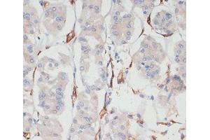 Immunohistochemistry of paraffin-embedded Human stomach using CD36 Polyclonal Antibody at dilution of 1:200 (40x lens). (CD36 antibody)