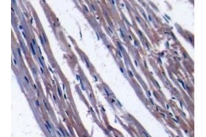 Immunohistochemistry (IHC) image for anti-Transcription Factor A, Mitochondrial (TFAM) (AA 43-244) antibody (ABIN1860702)
