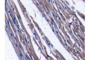 DAB staining on IHC-P; Samples: Rat Cardiac Muscle Tissue (TFAM antibody  (AA 43-244))