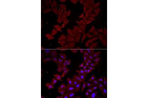 Immunofluorescence analysis of HeLa cell using CCT4 antibody. (CCT4 antibody)