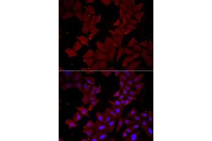 Immunofluorescence analysis of HeLa cell using CCT4 antibody. (CCT4 antibody)