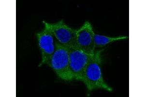 Confocal immunofluorescence image of LNCaP cells using AF488 labeled ODC-1 Mouse Monoclonal Antibody (ODC1/485) (Green). (ODC1 antibody)