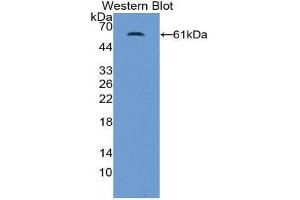 Western Blotting (WB) image for anti-Nuclear Receptor Subfamily 3, Group C, Member 2 (NR3C2) (AA 739-984) antibody (ABIN1859878) (NR3C2 antibody  (AA 739-984))