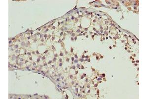Immunohistochemistry of paraffin-embedded human testis tissue using ABIN7160978 at dilution of 1:100 (CYB5R2 antibody  (AA 1-237))