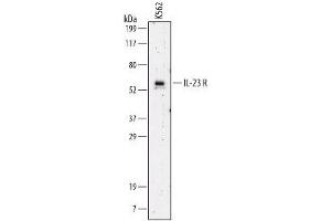 Image no. 1 for anti-Interleukin 23 Receptor (IL23R) (AA 24-354) antibody (ABIN204348)
