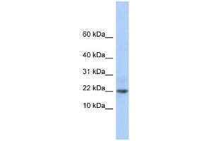 C9ORF25 antibody used at 1 ug/ml to detect target protein. (C9orf25 antibody  (Middle Region))