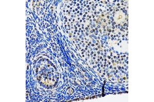 Immunohistochemistry of paraffin-embedded rat ovary using TP53 antibody. (p53 antibody  (AA 1-100))
